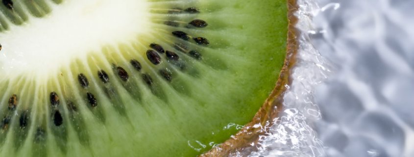 Die Kiwi – Der grüne Exot