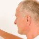 Haarausfall bei Männern - was hilft?