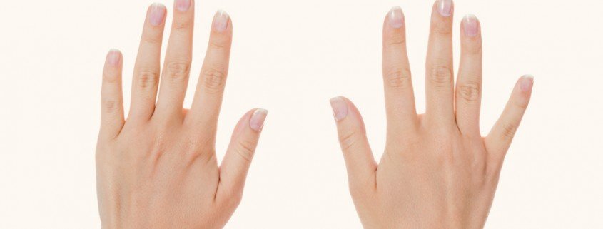 Das Raynaud-Syndrom: die Leichenfingerkrankheit