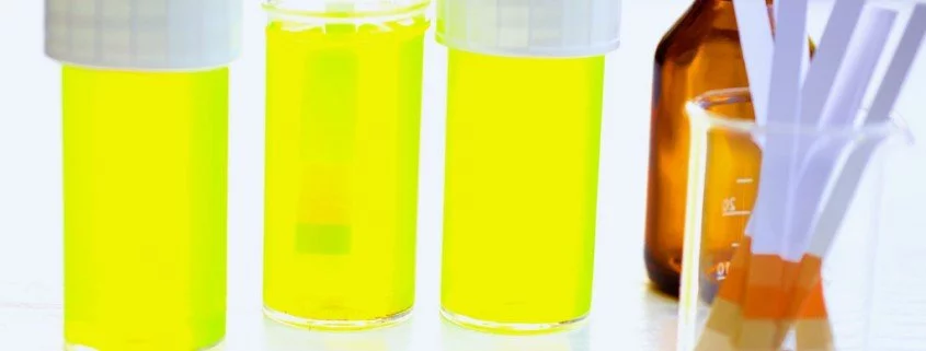 Urin trinken - wie sinnvoll ist diese Therapieform wirklich?