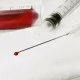 Eigenbluttherapie: Grundlagen, Gefahren, Prinzipien