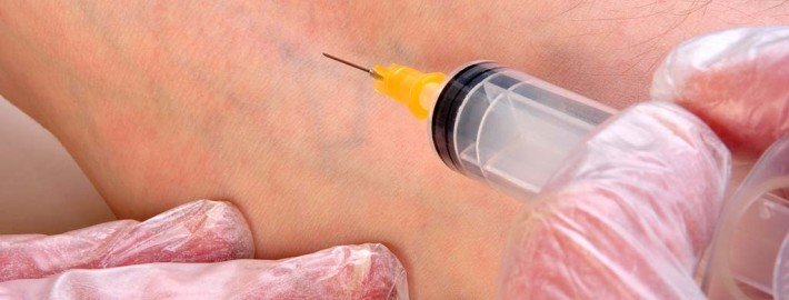 Gebärmutterhalskrebs & die umstrittene Impfung
