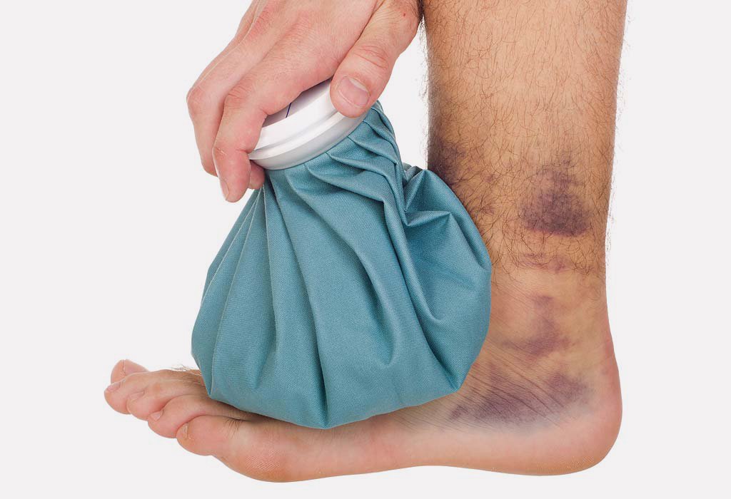 Rheuma und Naturheilverfahren: Was hilft tatsächlich?