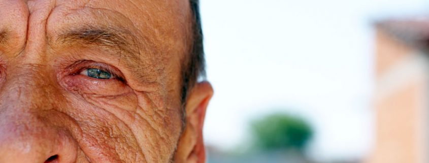 Neue Untersuchungsmethode - frühzeitige Alzheimer Diagnose