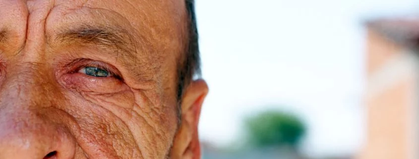 Neue Untersuchungsmethode - frühzeitige Alzheimer Diagnose