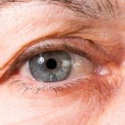 Die Uveitis - eine gefährliche Augenentzündung