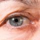 Die Uveitis - eine gefährliche Augenentzündung